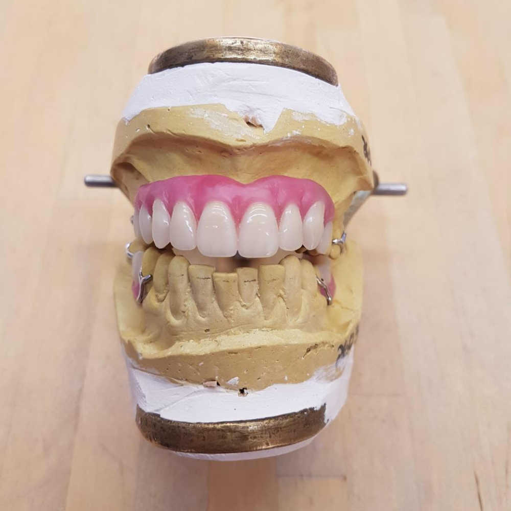 Plaques de base pour prothèses dentaires - Distributeur de máteriel  dentaire - Dentaltix